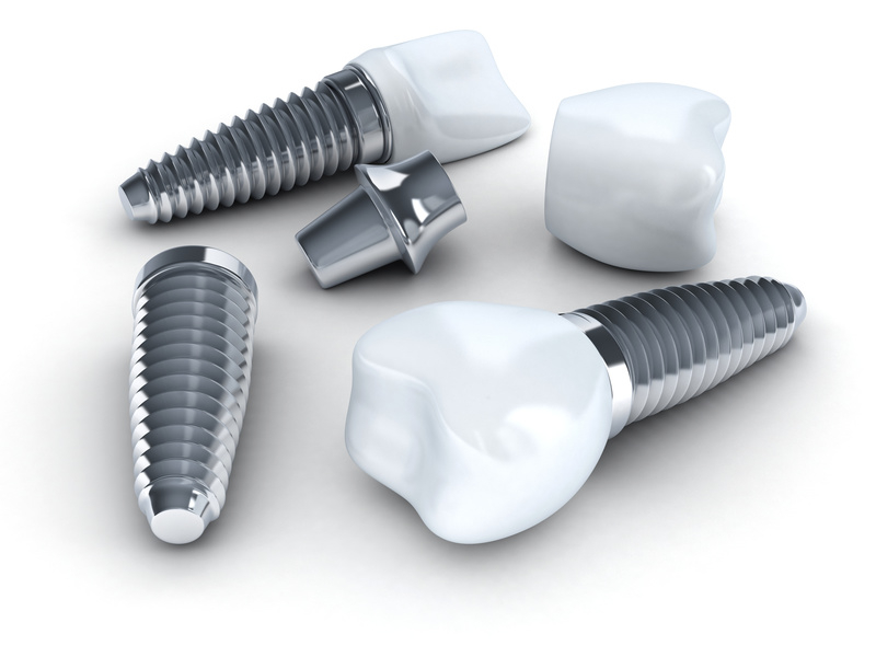Implanty Rzeszów - leczenie implantologiczne Rzeszów implanty